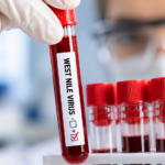 Laboratorne testovanie West Nile virusu