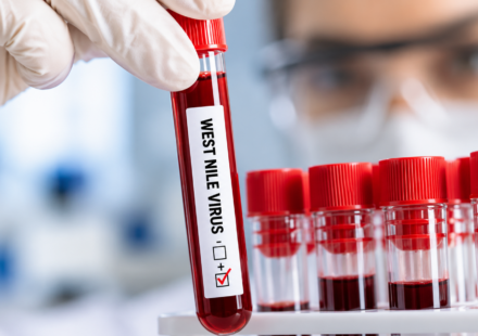 Laboratorne testovanie West Nile virusu