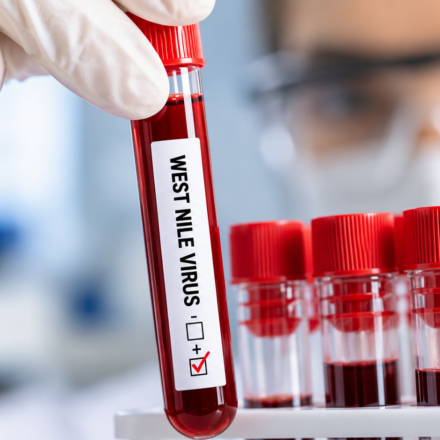 Laboratorne testovanie West Nile virusu