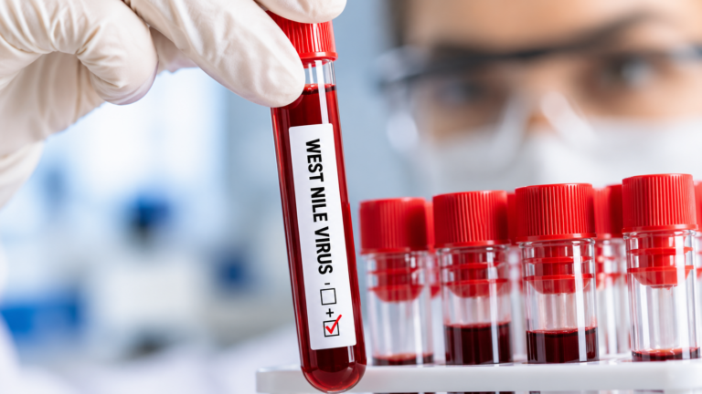 Laboratorne testovanie West Nile virusu